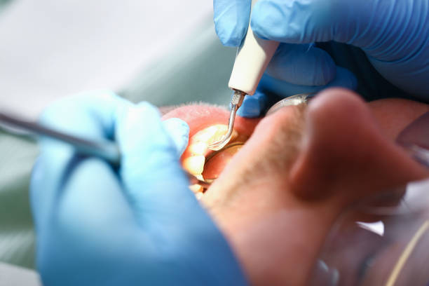 Best Cracked Tooth Emergency Dentist  in Chaffee, MO